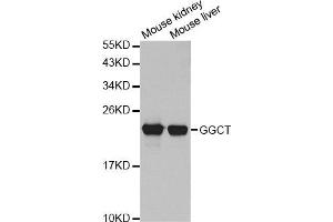 Western Blotting (WB) image for anti-gamma-Glutamylcyclotransferase (GGCT) antibody (ABIN1876220) (GGCT 抗体)