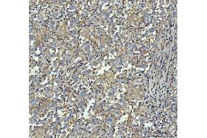 IHC analysis of Talin 1/TLN1 using anti-Talin 1/TLN1 antibody (ABIN7600227).