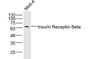 Molt-4 lysates probed with Insulin Receptor Beta Polyclonal Antibody, Unconjugated  at 1:300 dilution and 4˚C overnight incubation. (ISR-beta 抗体  (AA 1001-1100))