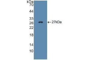 Western blot analysis of recombinant Mouse FBN1. (Fibrillin 1 抗体  (AA 957-1143))