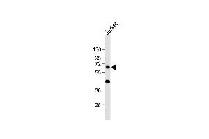 Anti- at 1:1000 dilution + Jurkat whole cell lysate Lysates/proteins at 20 μg per lane. (CYP1A1 抗体  (C-Term))