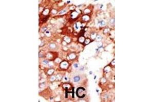 Immunohistochemistry (IHC) image for anti-Acyl-CoA Synthetase Long-Chain Family Member 4 (ACSL4) antibody (ABIN3001550) (ACSL4 抗体)