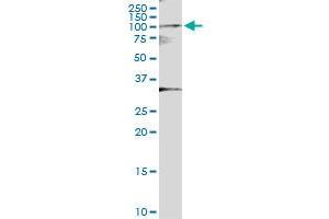 Immunoprecipitation of MYST2 transfected lysate using anti-MYST2 MaxPab rabbit polyclonal antibody and Protein A Magnetic Bead , and immunoblotted with MYST2 MaxPab mouse polyclonal antibody (B01) . (MYST2 抗体  (AA 1-611))