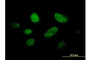 Immunofluorescence of purified MaxPab antibody to C14orf106 on HeLa cell. (MIS18 Binding Protein 1 (MIS18BP1) (AA 1-314) 抗体)