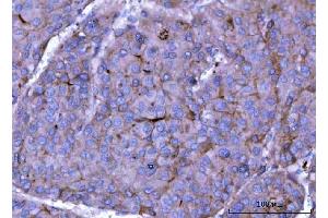 IHC analysis of ch TOG/CKAP5 using anti-ch TOG/CKAP5 antibody (ABIN6719294).