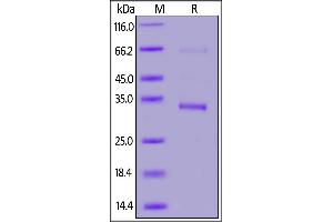 SARS-CoV-2 Envelope (SARS-CoV-2 E) protein (His tag,GST tag)