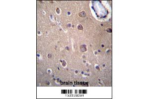 Immunohistochemistry (IHC) image for anti-Solute Carrier Family 8 (Sodium/calcium Exchanger), Member 3 (SLC8A3) (AA 585-614), (C-Term) antibody (ABIN5535006)