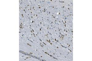 IHC analysis of Transketolase/TKT using anti-Transketolase/TKT antibody (ABIN7598959).
