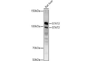 Western blot analysis of extracts of Rat liver, using ST antibody (ABIN1678782, ABIN3017845, ABIN3017846 and ABIN7101526) at 1:1000 dilution. (STAT2 抗体)