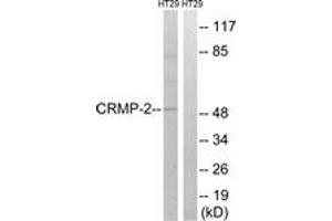 Western blot analysis of extracts from HT-29 cells, treated with heat shock, using CRMP-2 (Ab-509) Antibody.