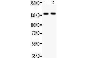 Anti- CD62P Picoband antibody, Western blotting All lanes: Anti CD62P  at 0. (P-Selectin 抗体  (AA 42-271))