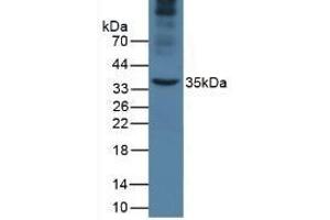 Detection of APOA5 in Mouse Liver Tissue using Monoclonal Antibody to Apolipoprotein A5 (APOA5) (APOA5 抗体  (AA 21-210))
