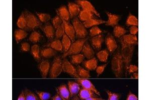 Immunofluorescence analysis of HeLa cells using ATP5D Polyclonal Antibody at dilution of 1:100. (ATP5F1D 抗体)