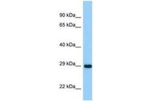 Image no. 1 for anti-Ankyrin Repeat and SOCS Box-Containing 11 (ASB11) (AA 21-70) antibody (ABIN6748270) (ASB11 抗体  (AA 21-70))