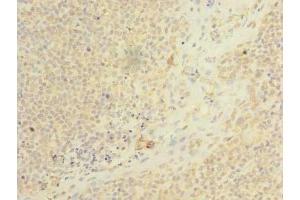 Immunohistochemistry of paraffin-embedded human tonsil tissue using ABIN7158460 at dilution of 1:100 (ARMC9 抗体  (AA 401-665))