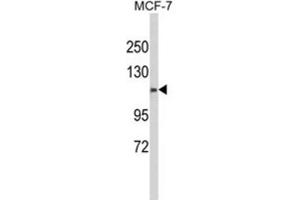 Western Blotting (WB) image for anti-Calponin Homology Domain Containing 2 (CHDC2) antibody (ABIN3003994) (CXorf22 抗体)