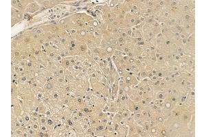 ABIN6265845 and ABIN6273337 at 1/100 staining human normal liver tissue by IHC-P.