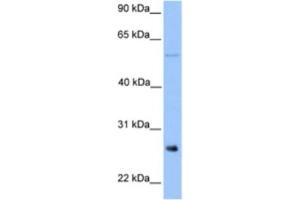 Western Blotting (WB) image for anti-Methyltransferase Like 7B (METTL7B) antibody (ABIN2463256) (METTL7B 抗体)
