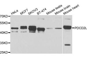 Western blot analysis of extracts of various cell lines, using PDCD2L antibody. (PDCD2L 抗体)