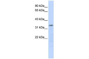 Western Blotting (WB) image for anti-Polymerase (RNA) III (DNA Directed) Polypeptide F, 39 KDa (POLR3F) (Middle Region) antibody (ABIN2783472)
