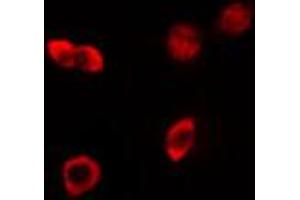ABIN6274163 staining HeLa cells by IF/ICC. (HKR1 抗体)