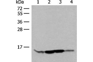 Western blot analysis of HL60 Hela 231 cell Human breast cancer tissue lysates using RPP14 Polyclonal Antibody at dilution of 1:400 (RPP14 抗体)