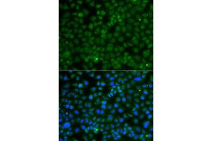 Immunofluorescence analysis of A549 cell using WDR45 antibody. (WDR45 抗体)
