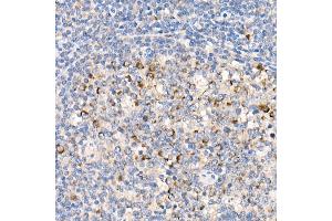 Immunohistochemistry (IHC) image for anti-Acyl-CoA Synthetase Long-Chain Family Member 4 (ACSL4) antibody (ABIN7265424)