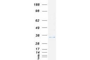 Western Blotting (WB) image for Ribosomal Protein, Large, P0 (RPLP0) (Transcript Variant 2) protein (Myc-DYKDDDDK Tag) (ABIN2731152)