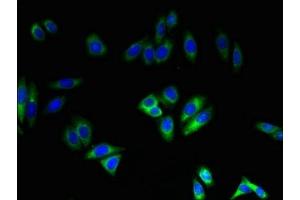 Immunofluorescent analysis of HepG2 cells using ABIN7161010 at dilution of 1:100 and Alexa Fluor 488-congugated AffiniPure Goat Anti-Rabbit IgG(H+L) (NADPH Oxidase 4 抗体  (AA 210-424))