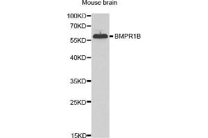 Western Blotting (WB) image for anti-Bone Morphogenetic Protein Receptor, Type IB (BMPR1B) (AA 1-126) antibody (ABIN6219169) (BMPR1B 抗体  (AA 1-126))