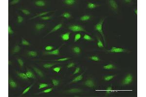 Immunofluorescence (IF) image for anti-Fanconi Anemia, Complementation Group C (FANCC) (AA 1-558) antibody (ABIN947854)