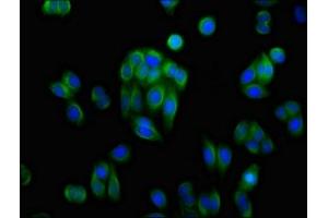 Immunofluorescence staining of HepG2 cells with ABIN7143686 at 1:100, counter-stained with DAPI. (AKR1C1 抗体  (AA 219-323))