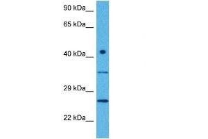 Host:  Rabbit  Target Name:  CTDNEP1  Sample Tissue:  Human MCF7 Whole Cell  Antibody Dilution:  1ug/ml (CTDNEP1A 抗体  (Middle Region))