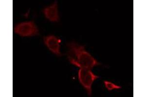 ABIN6274733 staining HT29 by IF/ICC. (MRPL18 抗体)