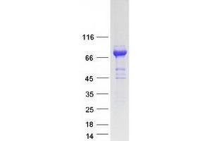 Validation with Western Blot