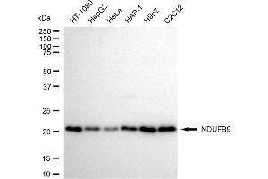 Western blotting analysis using NDUFB9 antibody (ABIN7799553).