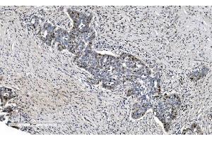 IHC analysis of MCM6 using anti-MCM6 antibody (ABIN7600036). (MCM6 抗体  (AA 14-821))