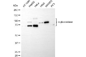 Western blotting analysis using alpha glucosidase antibody (ABIN7797585). (Recombinant AGLU 抗体)