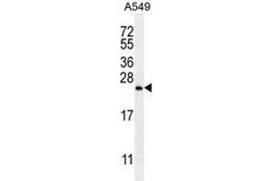 SNX24 Antikörper  (N-Term)