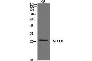 Western Blot (WB) analysis of KB cells using CD30-L Polyclonal Antibody. (TNFSF8 抗体  (Internal Region))