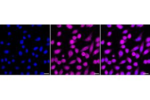 Immunocytochemical staining of HepG2 cells with Nibrin antibody (ABIN7799592), 1:1,000). (Recombinant Nibrin 抗体)