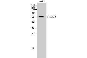 Western Blotting (WB) image for anti-Forkhead Box C1 (FOXC1) (Internal Region) antibody (ABIN3184652) (FOXC1 抗体  (Internal Region))