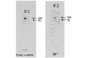 Western blot using  affinity purified anti-ABCB6 antibody (right panel, lane B6) shows detection of Flag tagged human ABCB6 protein at 104 kDa and a truncated form of the protein at 79 kDa (arrowheads). (ABCB6 抗体  (AA 440-455))