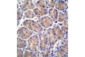 Immunohistochemistry (Paraffin-embedded Sections) (IHC (p)) image for anti-Galactosamine (N-Acetyl)-6-Sulfate Sulfatase (GALNS) (AA 243-271), (Middle Region) antibody (ABIN952441)