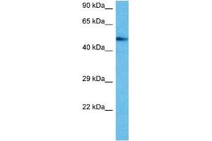 Western Blotting (WB) image for anti-V-Ets Erythroblastosis Virus E26 Oncogene Homolog 2 (ETS2) (Middle Region) antibody (ABIN2780665)