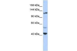 KCNH3 antibody used at 1 ug/ml to detect target protein. (KCNH3 抗体)