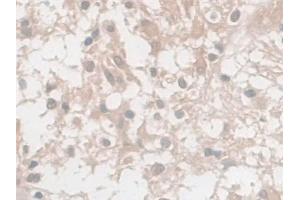 Immunohistochemistry (IHC) image for anti-Enolase 2 (Gamma, Neuronal) (ENO2) (AA 2-285) antibody (ABIN7427918)