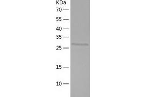 TRPT1 Protein (AA 1-253) (His tag)