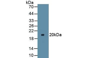 Detection of Recombinant IkBa, Mouse using Polyclonal Antibody to Inhibitory Subunit Of NF Kappa B Alpha (IkBa) (Inhibitory Subunit Of NF kappa B alpha 抗体)